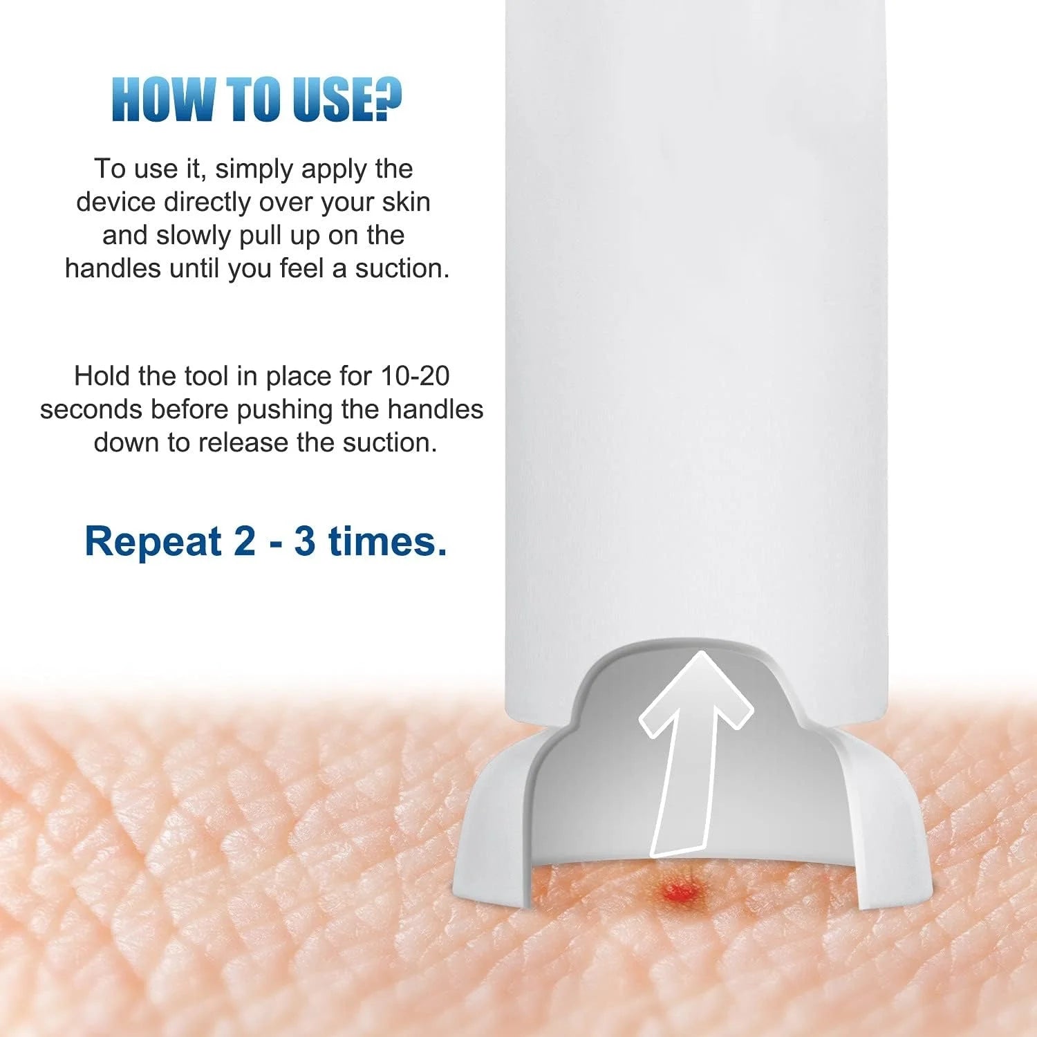 Natural Insect Bite Relief Suction Tool – Pain-Free Bug Venom Extractor for Hiking & Outdoors