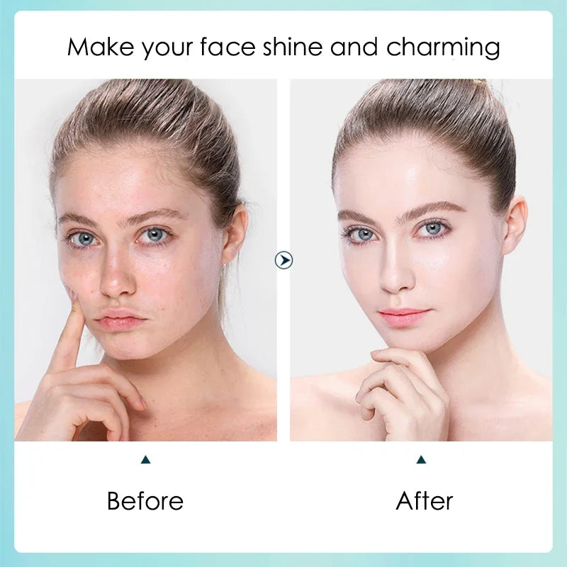 10x Hyaluronic Acid Face Masks – Intense Hydration & Pore Refining Sheet Mask Set