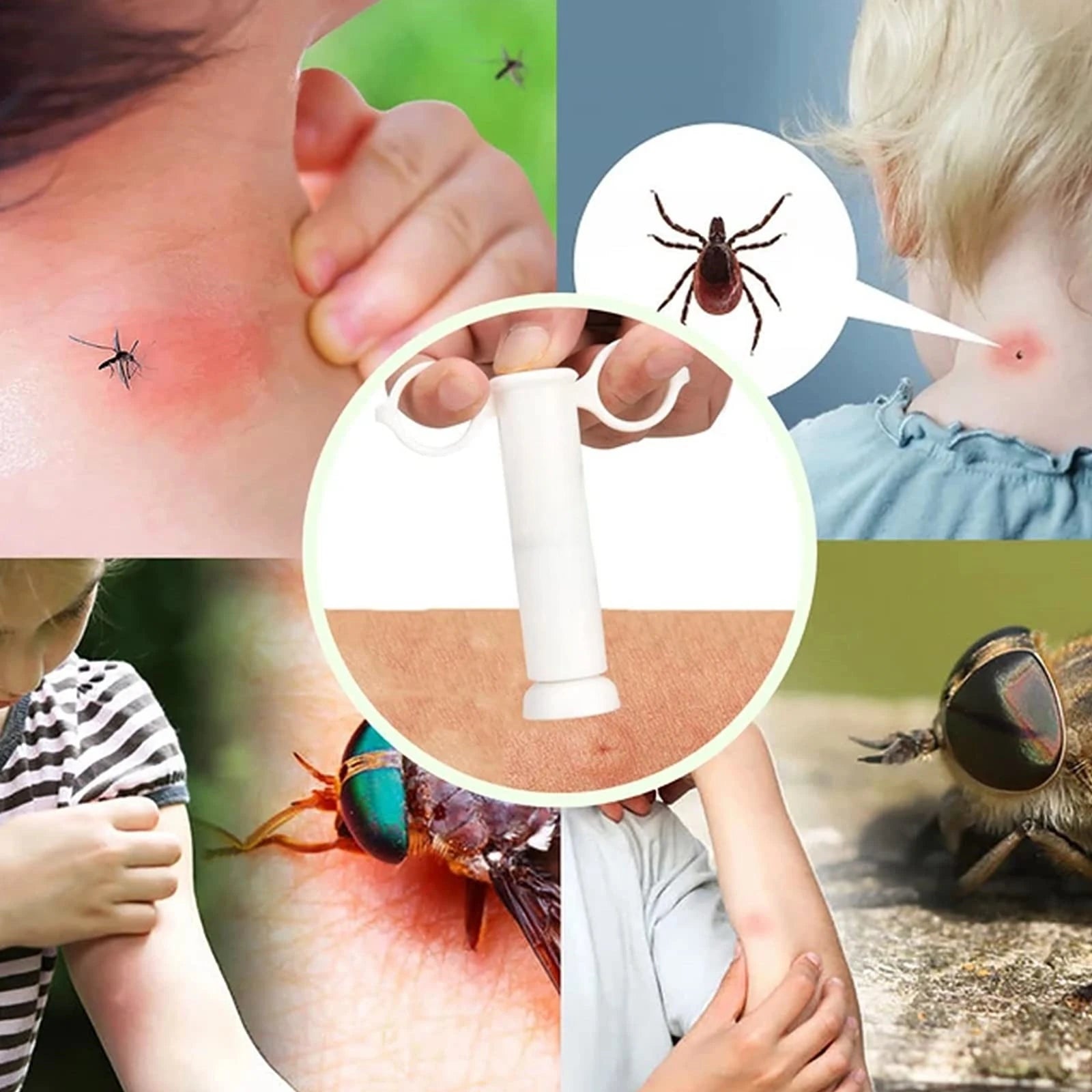 Natural Insect Bite Relief Suction Tool – Pain-Free Bug Venom Extractor for Hiking & Outdoors