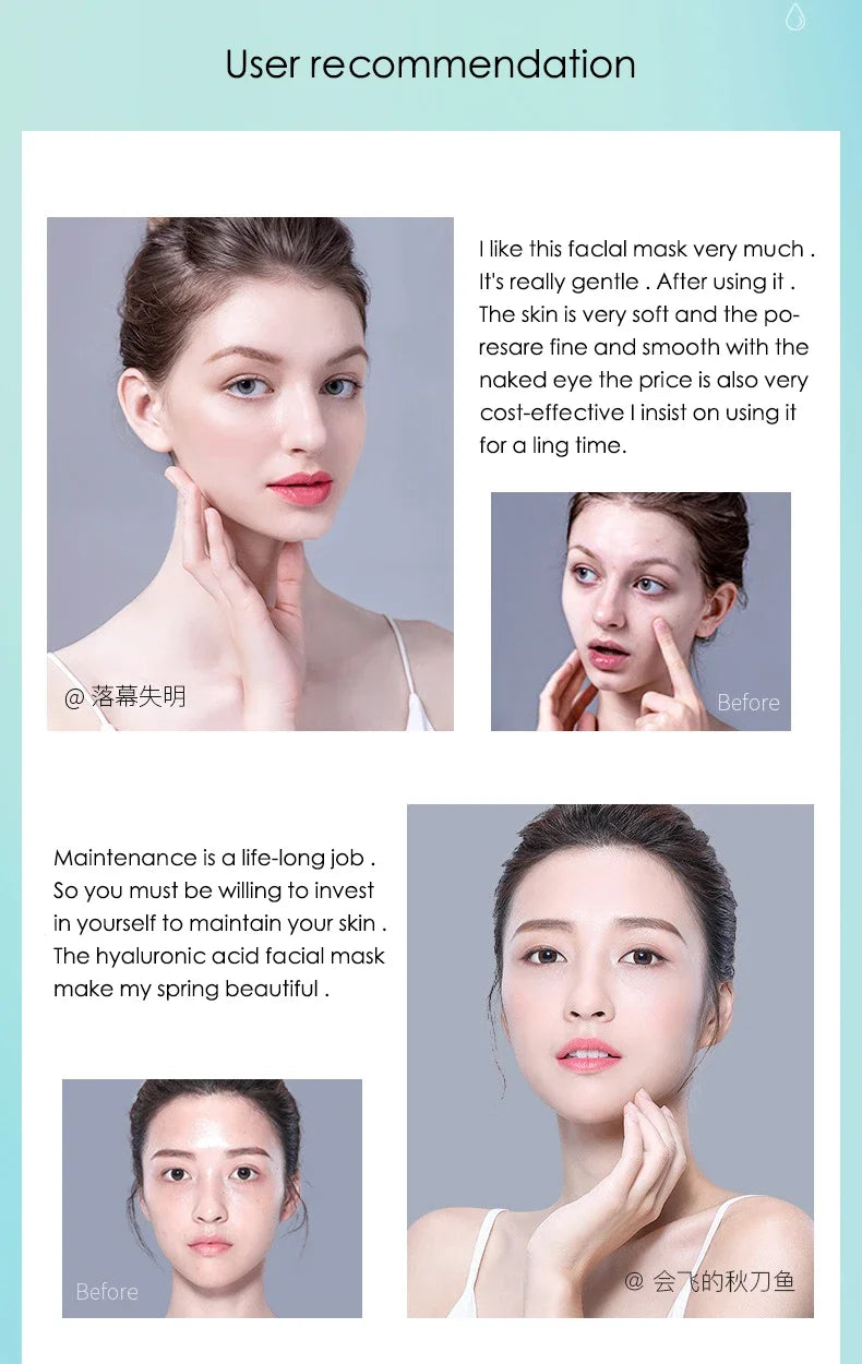 10x Hyaluronic Acid Face Masks – Intense Hydration & Pore Refining Sheet Mask Set