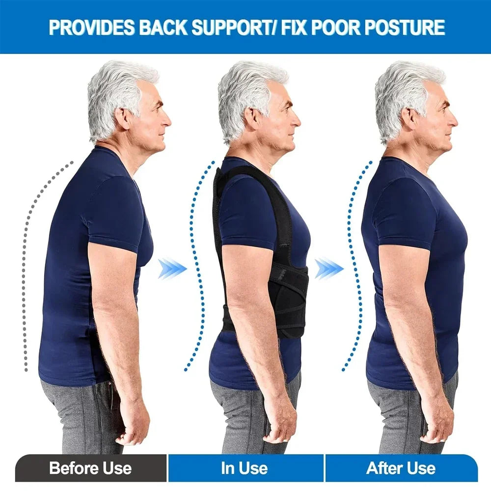 Back Posture Corrector – Relieve Pain & Improve Alignment