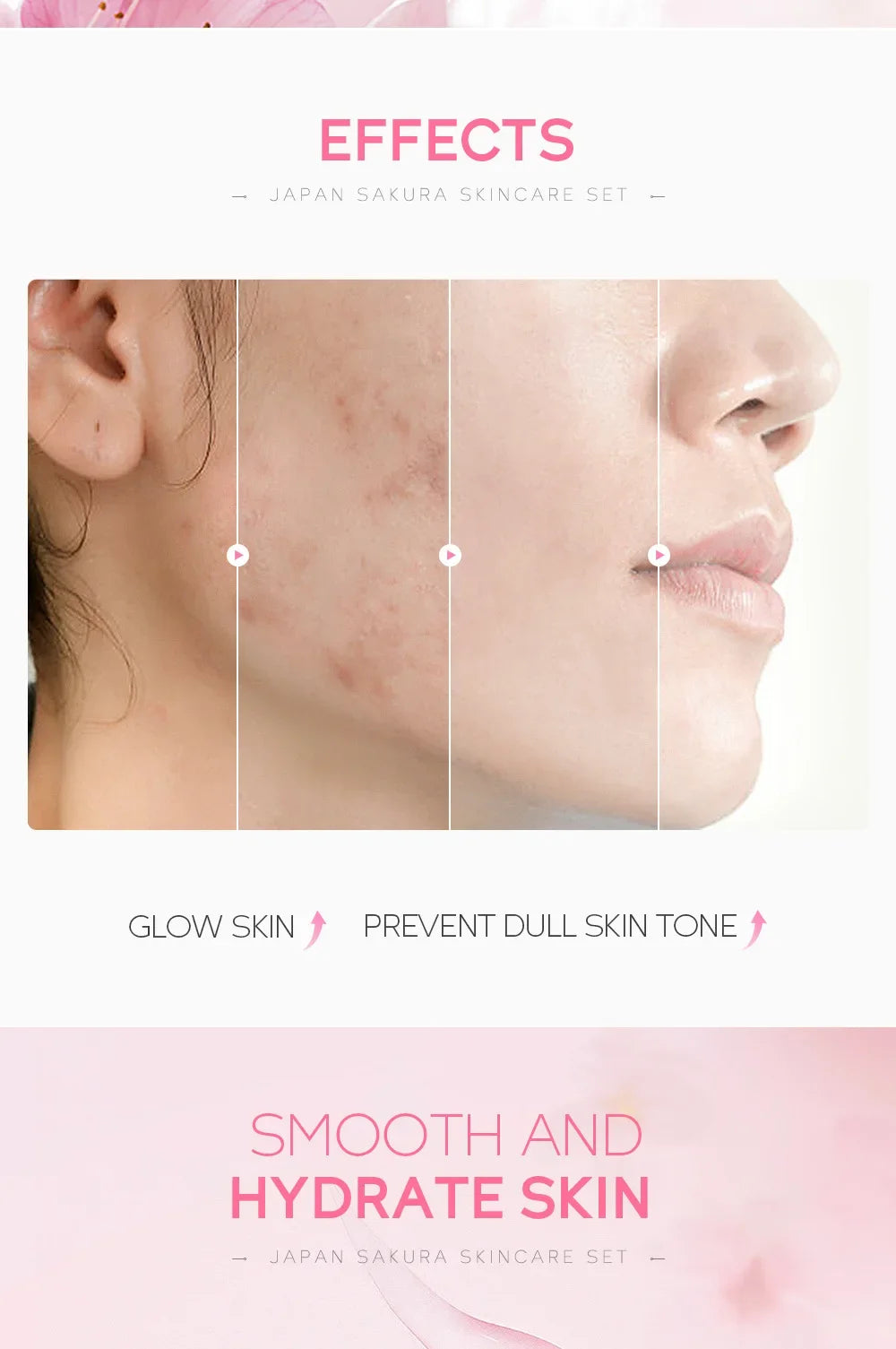 Korean Sakura Skincare Set – 5-Piece Hydration & Anti-Aging Kit by LAIKOU