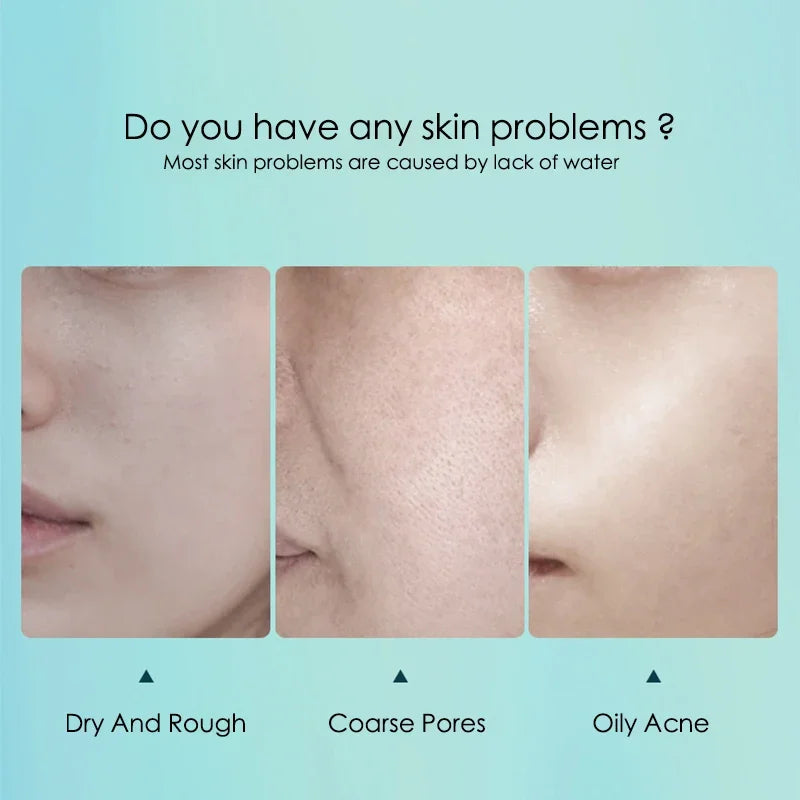 10x Hyaluronic Acid Face Masks – Intense Hydration & Pore Refining Sheet Mask Set